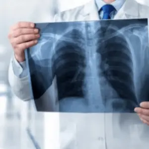 Doctor holding a chest X-ray film used for medical imaging archiving and digitization